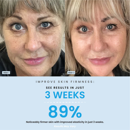 Anti-Aging Collagen Boost Daily Serum