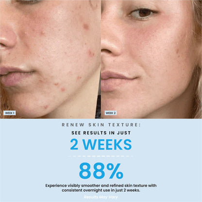 Overnight Collagen Face Mask